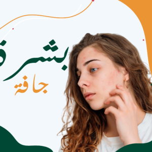 البشرة الجافة